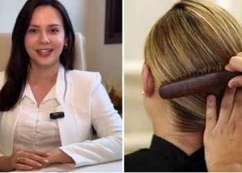 Larissa Crestani, dermatologista, “Penteados que causam alopecia de tração”