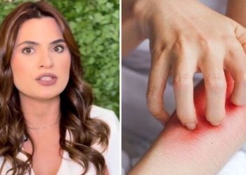 Talita Miranda, médica "Pessoas com TDAH tem 5% mais chances de ter Skin Picking"