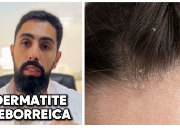 Hussein Awada, médico “Isso não é pele ressecada”
