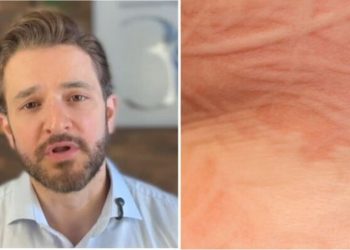 Rubens Pontello, "Você consegue escrever na sua pele? O que isso pode ser?"