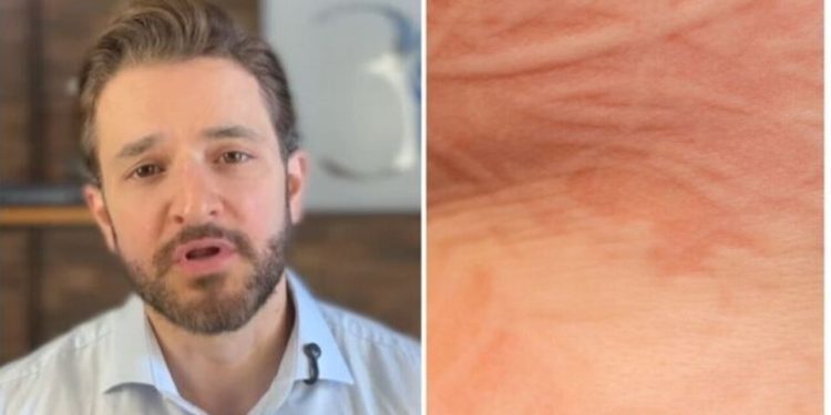 Rubens Pontello, "Você consegue escrever na sua pele? O que isso pode ser?"