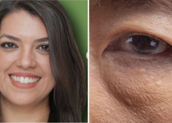 Juliana Gabriel, "Espasmos nas pálpebras são sinal de estresse?"