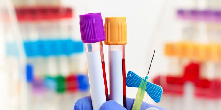 Curso de flebotomia abre vagas com formação completa e certificada
