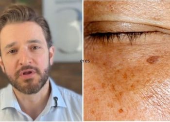 Rubens Pontello, médico "Você sofre com melasma e já tentou vários tratamentos sem sucesso?