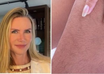 Cristina Salaro, "Excesso de pelos no corpo?"