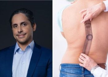 Breno Macêdo, médico "Principais sinais de Escoliose"