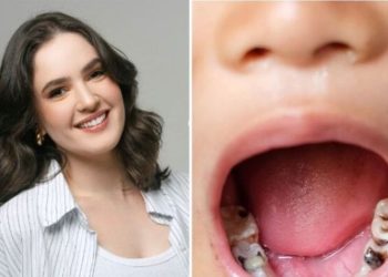 Vanessa Bastos, dentista "Antibiótico causa cárie?"
