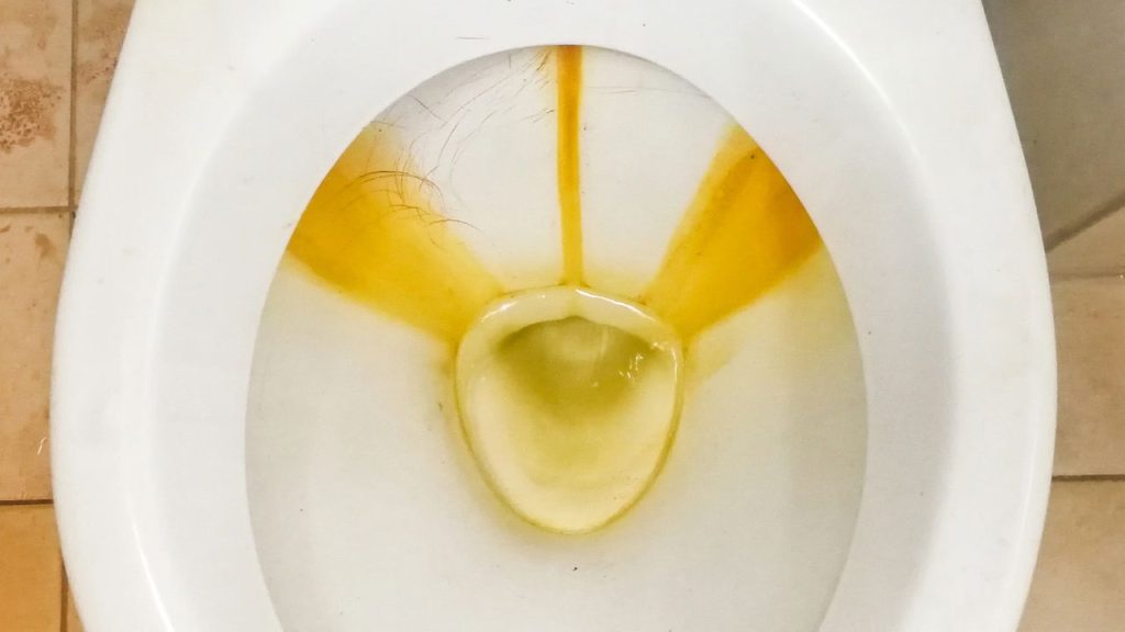 Vaso