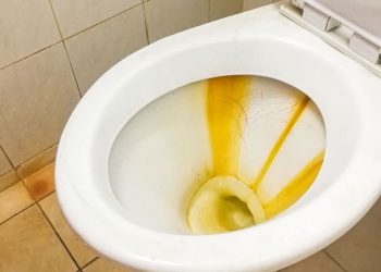 O truque caseiro que remove manchas do vaso em minutos e sem produtos caros