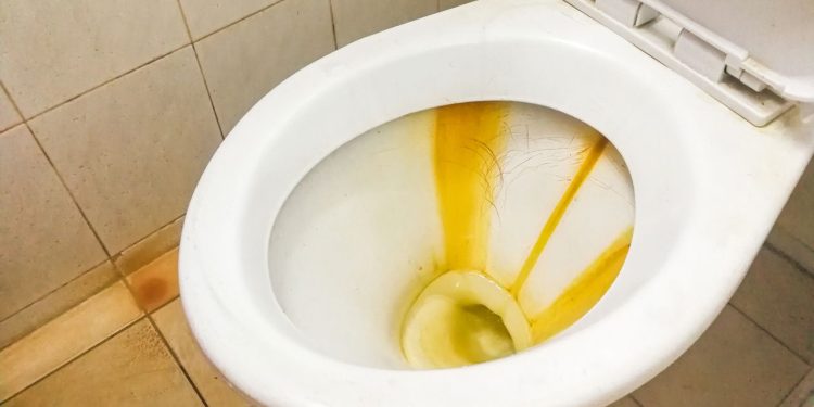O truque caseiro que remove manchas do vaso em minutos e sem produtos caros