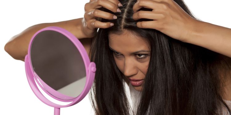 Cansado da caspa? Esse método caseiro pode ser a solução