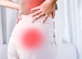 Você sabe o que é a Síndrome do Bumbum Morto?