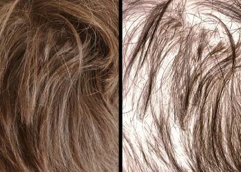 Como fazer o cabelo crescer mais rápido de forma natural