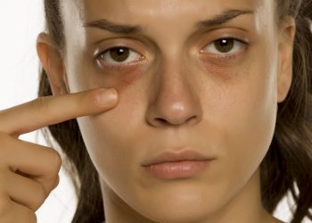 Métodos eficazes para eliminar olheiras sem gastar muito