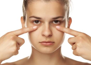 Olheiras: o que as causa e 5 soluções eficazes para reduzi-las ou disfarçá-las