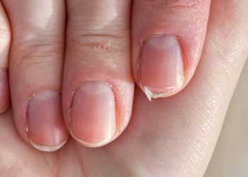 Unhas fracas? Veja cuidados simples que fortalecem e deixam suas mãos mais bonitas