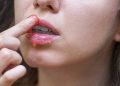 Adeus lábios ásperos: esse esfoliante de açúcar com mel garante suavidade imediata