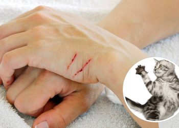 Se o seu gato arranha você ou foge quando você o acaricia, talvez o problema seja você