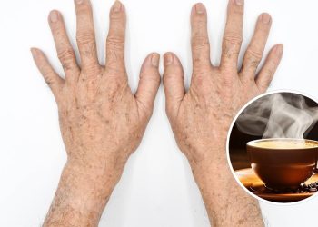 A melhor receita caseira para mãos secas e enrugadas