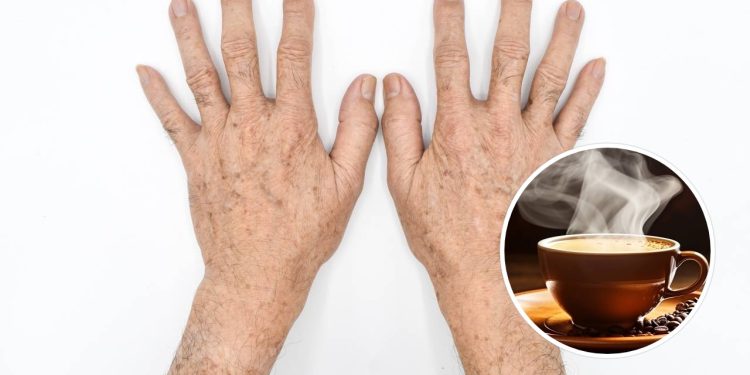 A melhor receita caseira para mãos secas e enrugadas