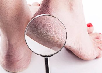 Seus pés estão ressecados? Veja como hidratar, esfoliar e relaxar com receitas caseiras
