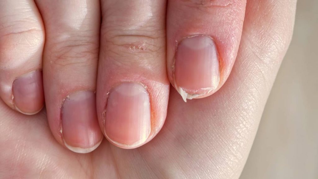 O segredo caseiro para unhas crescerem mais fortes e sem quebrar