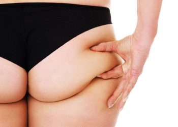 O método simples do dia a dia que acaba com a flacidez no bumbum