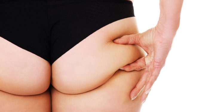 O método simples do dia a dia que acaba com a flacidez no bumbum