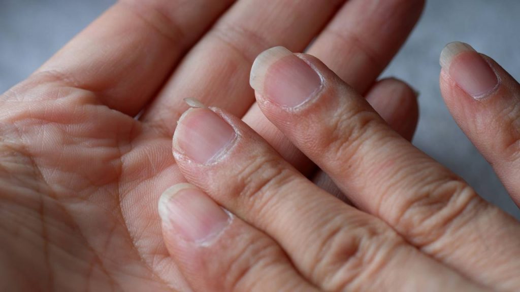 fortalecer unhas quebras 