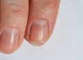 Unhas quebradiças? Saiba como fortalecê-las com hábitos simples