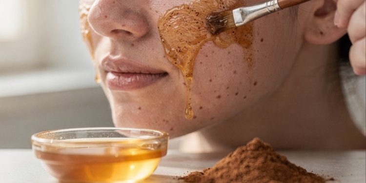 Usei mel e canela para acne e meu rosto ficou igual bunda de bebê