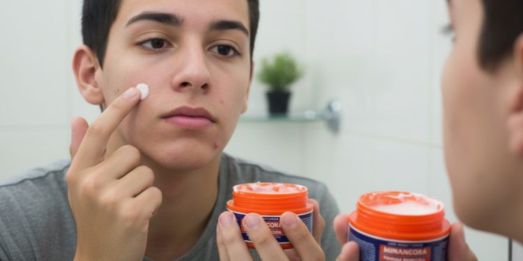 Essa pomada antiga e barata resolve muito além das espinhas