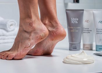 3 cremes de farmácia que dermatologistas indicam para hidratar rapidamente pés ressecados