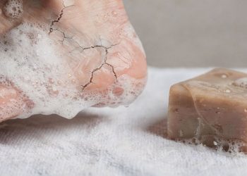 Esse sabão natural é a solução para seus pés rachados e unha encravada