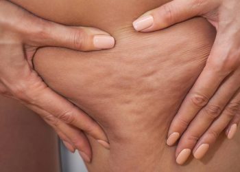 Aprenda os movimentos certos para estimular a circulação e potencializar seus exercícios, suavizando a pele em poucos minutos.