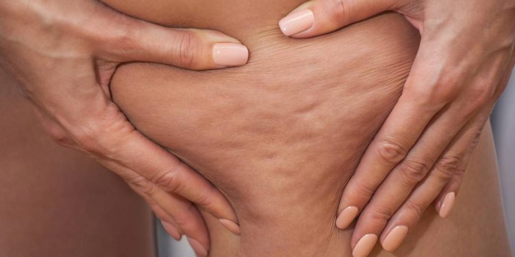 Aprenda os movimentos certos para estimular a circulação e potencializar seus exercícios, suavizando a pele em poucos minutos.