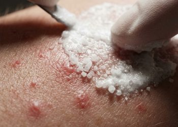 Pele macia e sedosa da noite para o dia: um remédio caseiro que funciona melhor do que sérum