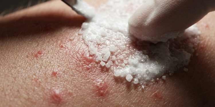 Pele macia e sedosa da noite para o dia: um remédio caseiro que funciona melhor do que sérum