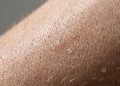 O que acontece com o corpo se você tomar banho apenas uma vez por semana