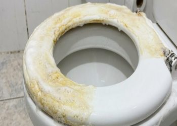Essa mistura simples consegue tirar o amarelado do assento do vaso sanitário em minutos