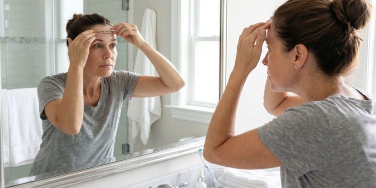 A alternativa mais barata que o Botox ganhou espaço na rotina de muitas mulheres