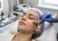Esse é o valor para fazer peeling químico e reduzir manchas escuras no rosto em uma clínica de estética