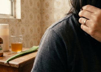 Vinagre, babosa e óleo de melaleuca contra caspa: o que ajuda e o que exige cuidado?