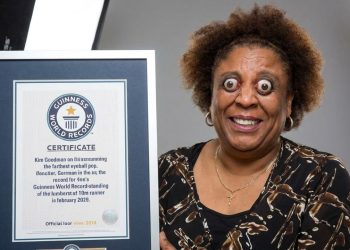Mulher com olhos “saltando” entrou para o Guinness e fotos continuam assustando a internet