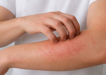 Segundo a psicologia coçar a pele repetidamente pode ser um sinal de alerta para esse tipo de problema