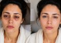 Diga adeus às olheiras: esta solução natural com apenas 1 ingrediente virou tendência entre quem quer reduzir o inchaço sem gastar fortunas