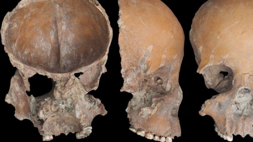 Arqueólogos descobrem objetos feitos de crânios humanos e tentam decifrar um enigma de 5.000 anos