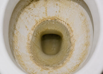 Nem produtos químicos nem receitas complicadas: a solução que remove o calcário antigo do vaso sanitário está na cozinha