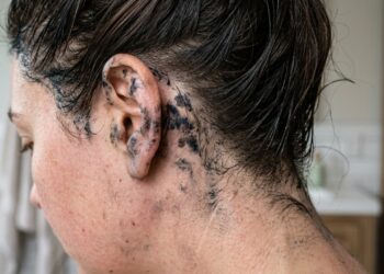 Pintou o cabelo em casa e manchou a pele: estes métodos inesperados ajudam a tirar a tinta sem sofrimento